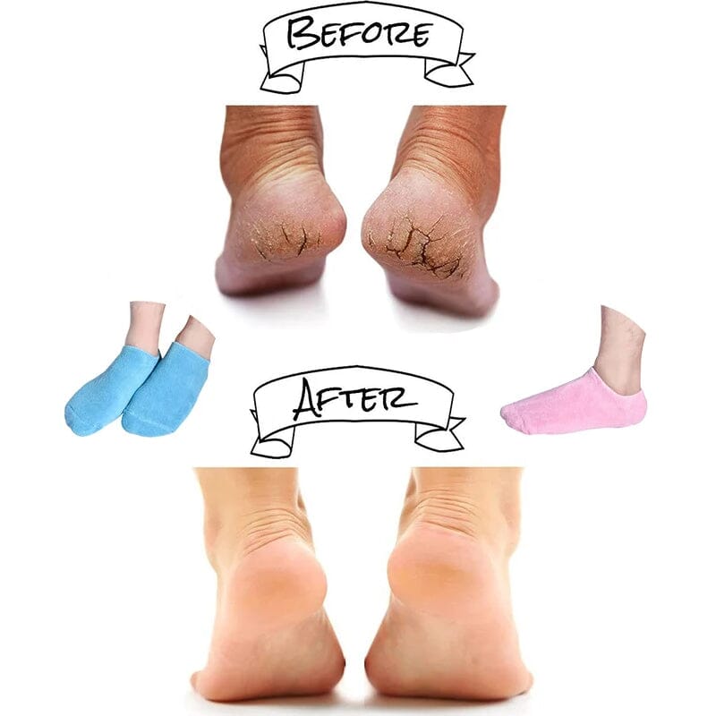 Lunesouri - Moisturizing Socks with Gel Lining